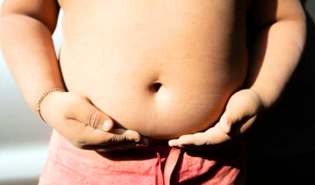 Obesity among children peaks in India-Telangana Today- PARAHUSHAR NEWS