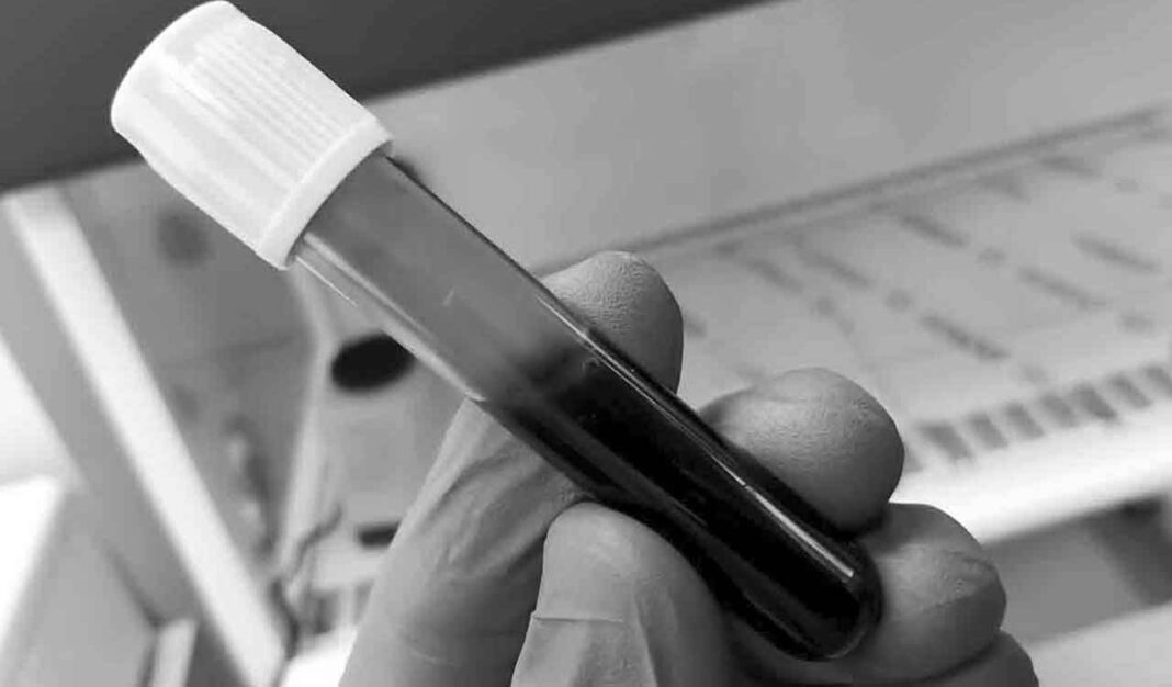 No more needles, as AI-tech based solutions deliver instant blood test results in minutes-Telangana Today- PARAHUSHAR NEWS
