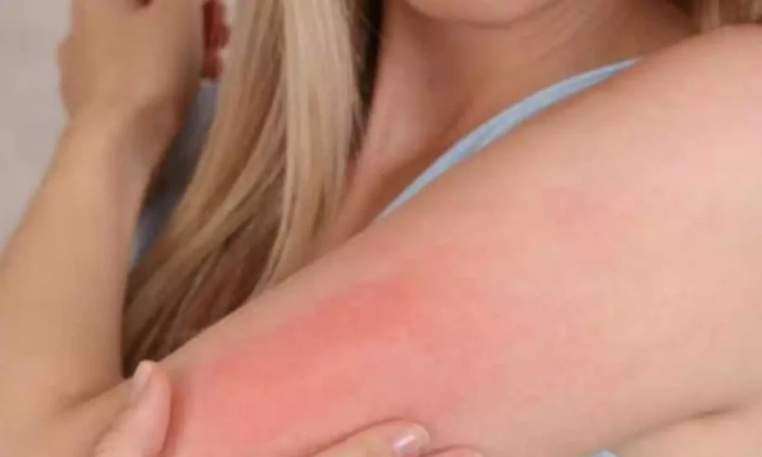 Health Tips: Why does skin itching or irritation during the rainy season?
– PARAHUSHAR NEWS