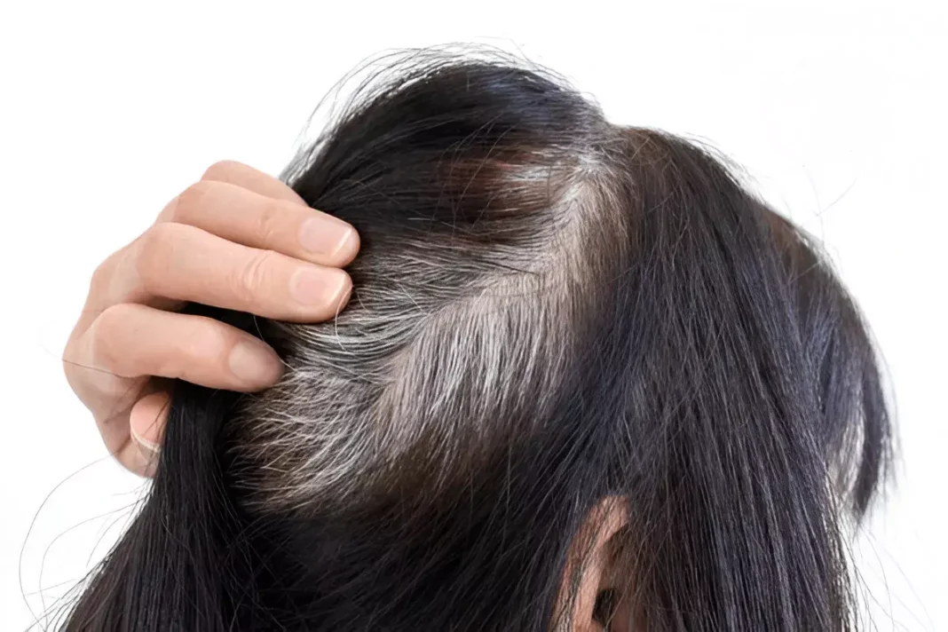 White Hair: To reduce white hair!
– PARAHUSHAR NEWS