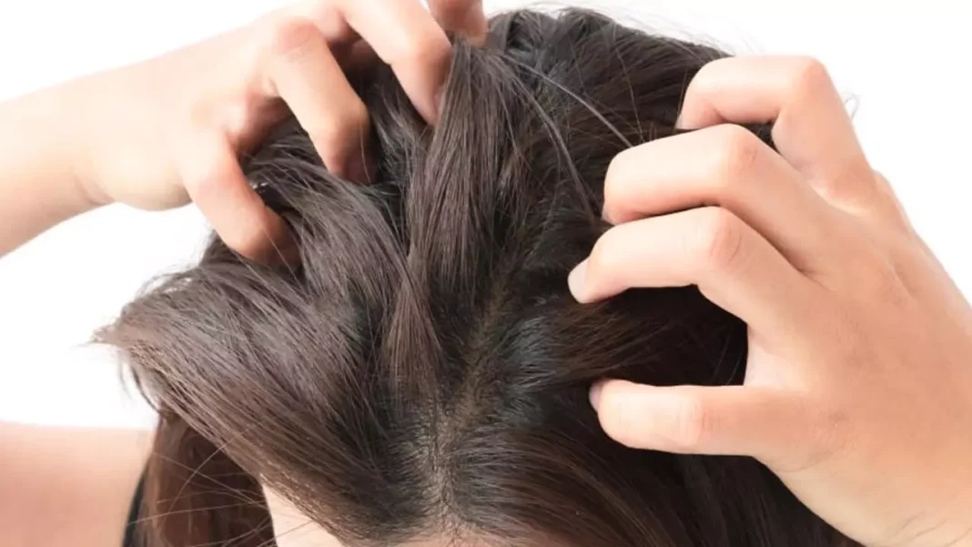 Scalp Itchy: Let’s get rid of itchy head like this..
– PARAHUSHAR NEWS