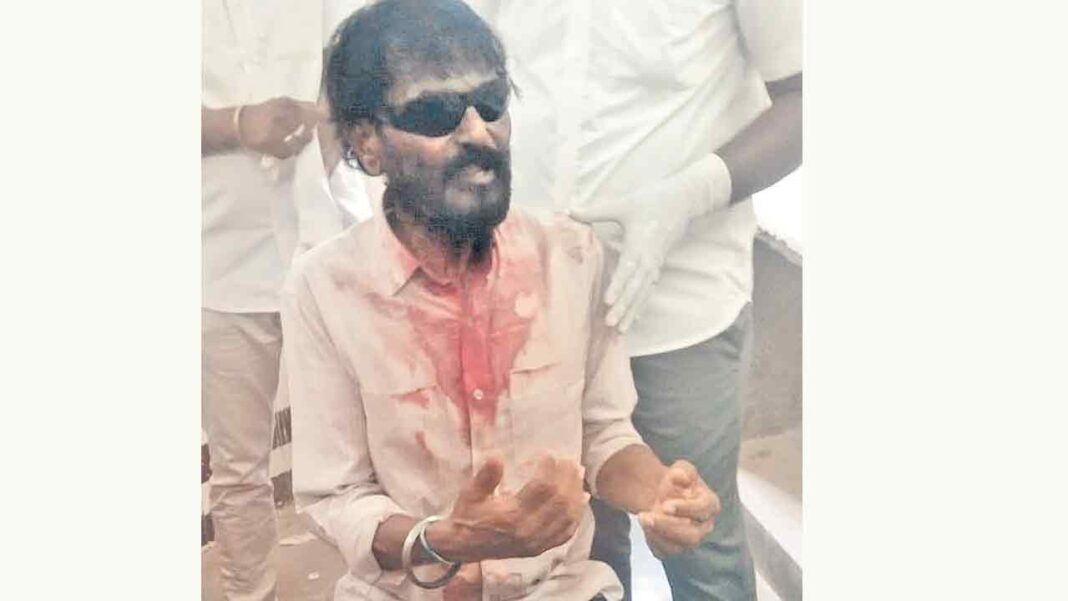 Attack on nature lover Dushar-Namasthe Telangana
– PARAHUSHAR NEWS