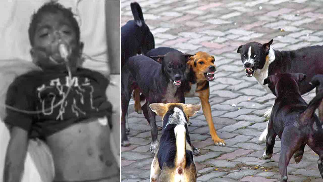 Street Dogs | Atrocious in Hyderabad.. 10 stray dogs attacked a boy