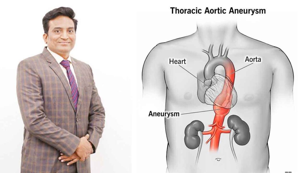 నిశ్శబ్దమైన కానీ ప్రాణాంతక వాస్కులర్ వ్యాధి
