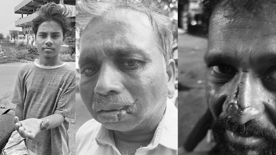 Dog Attack | Five seriously injured in mad dog attack.. Evacuation to Hyderabad-Namasthe Telangana
– PARAHUSHAR NEWS