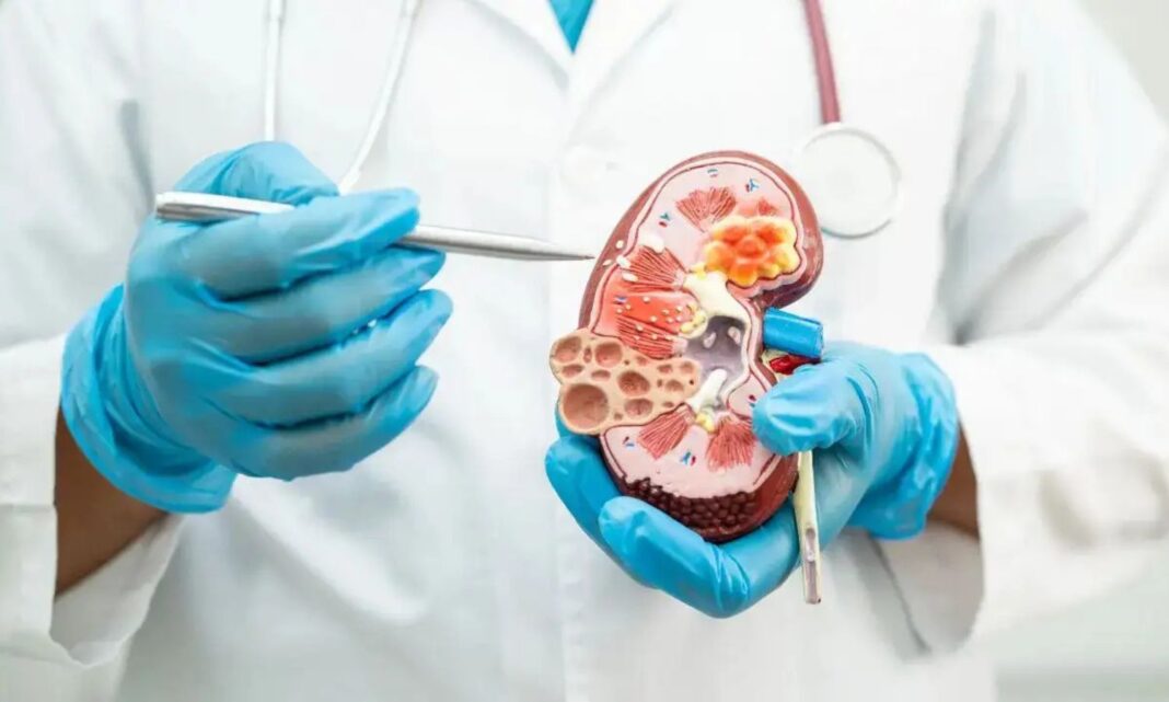 Health: Kidney diseases to increase drastically by 2040.. as the 5th leading cause of death
– PARAHUSHAR NEWS