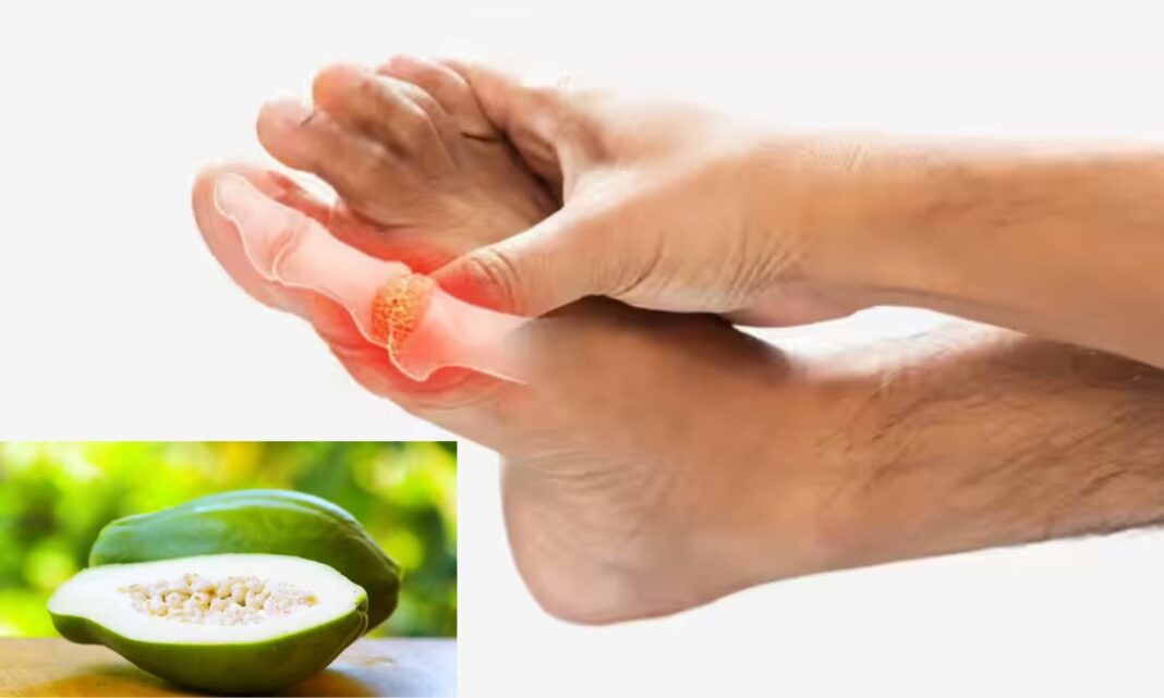 Natural Remedy for Uric Acid.. These are the benefits of raw papaya
